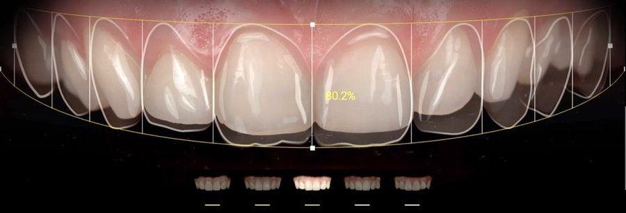 Clinica Dental Dominguez Lemus - diseño de sonrisas